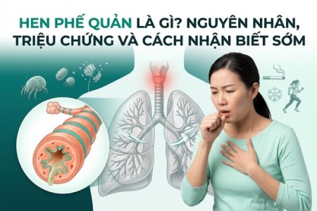 Hen Phế Quản Là Gì? Nguyên Nhân, Triệu Chứng Và Cách Nhận Biết Sớm