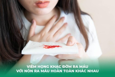 Viêm họng ho ra đờm có máu: Nguyên nhân và cách xử lý
