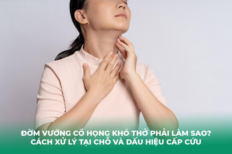 Đờm Vướng Cổ Họng Khó Thở Phải Làm Sao? Cách Xử Lý Tại Chỗ Và Dấu Hiệu Cấp Cứu