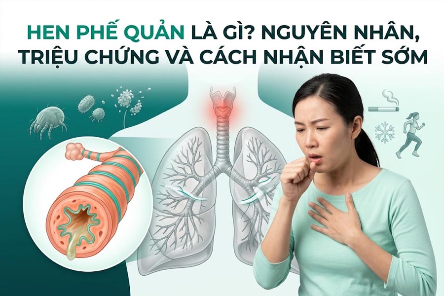 Hen Phế Quản Là Gì? Nguyên Nhân, Triệu Chứng Và Cách Nhận Biết Sớm